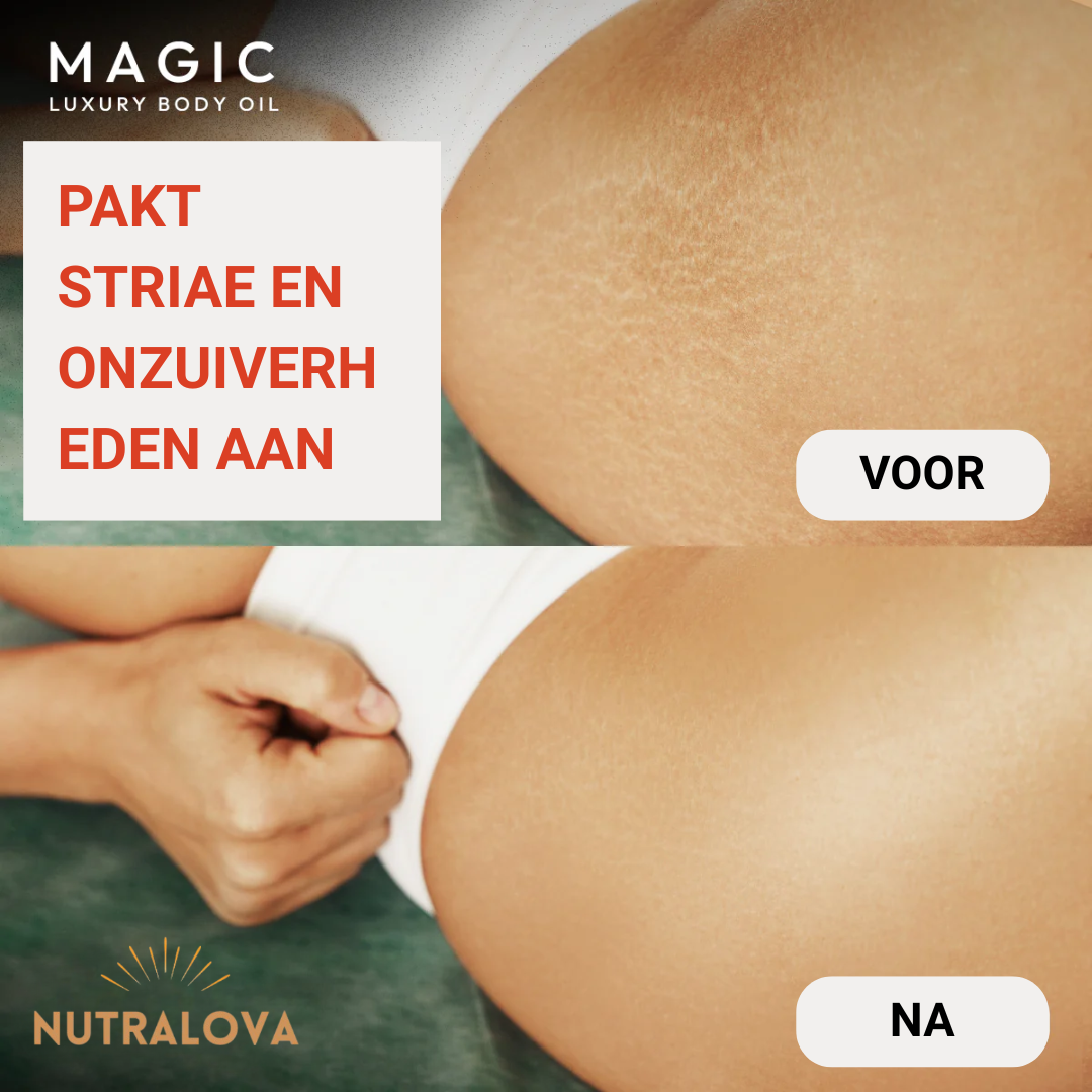 Nutralova™  Magic Body Oil - 100ml